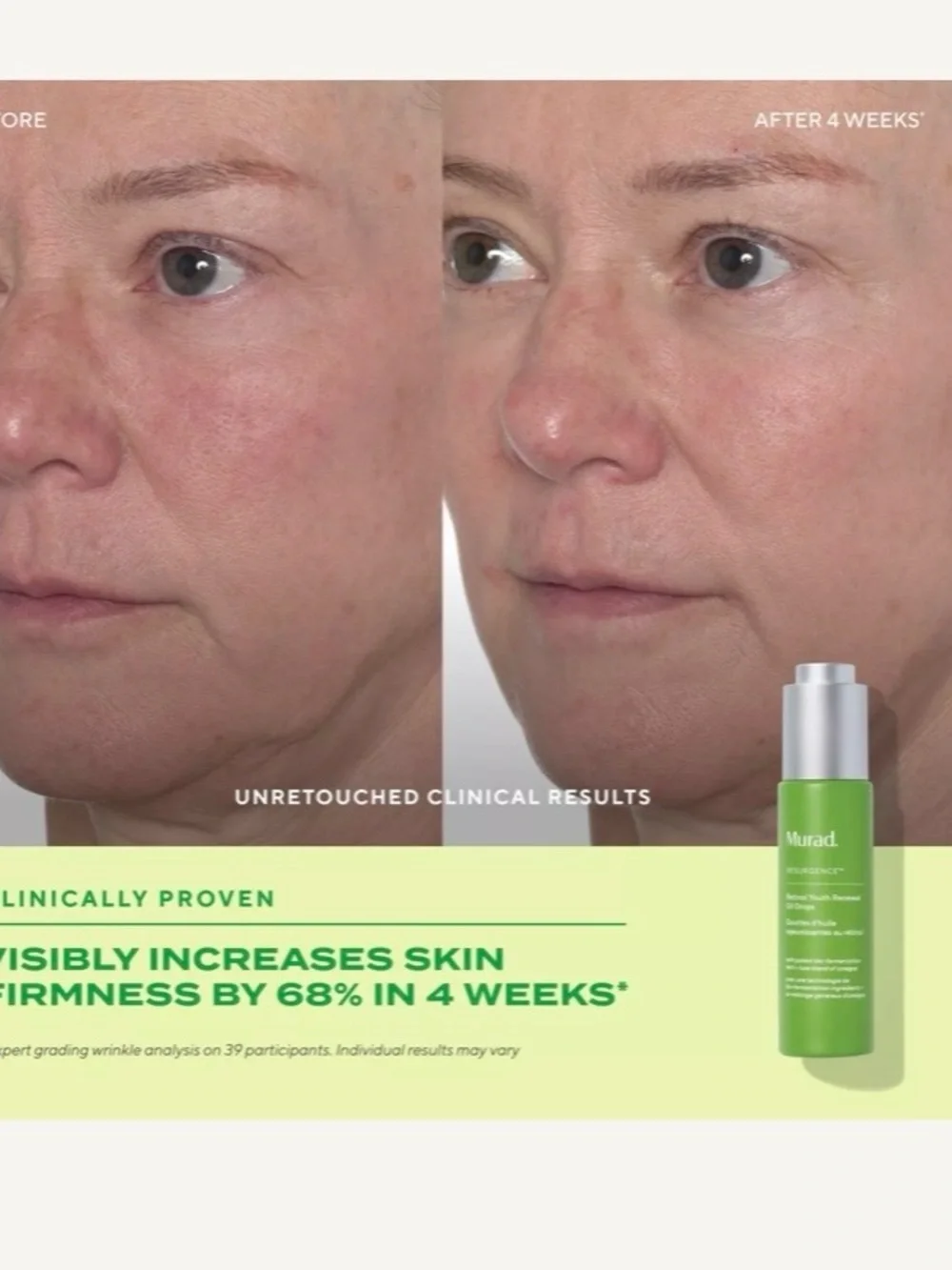 Murad Resurgence Retinol Youth Renewal Oil Drops — Green